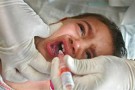 Diagnosis TBC Anak