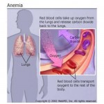 Tingkatan Anemia